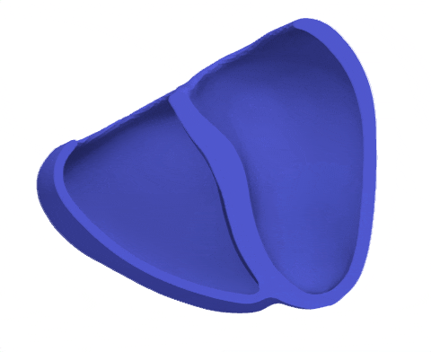 Contracting Left Ventricle